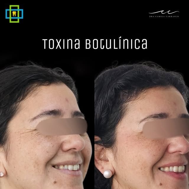 Publicación de Dental Melipilla en Instagram