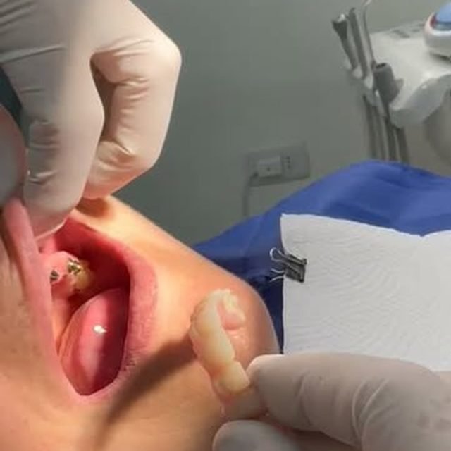 Reel de Dental Melipilla en Instagram
